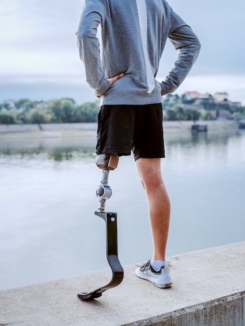 integrated-op-services-hm-orthopro-reno